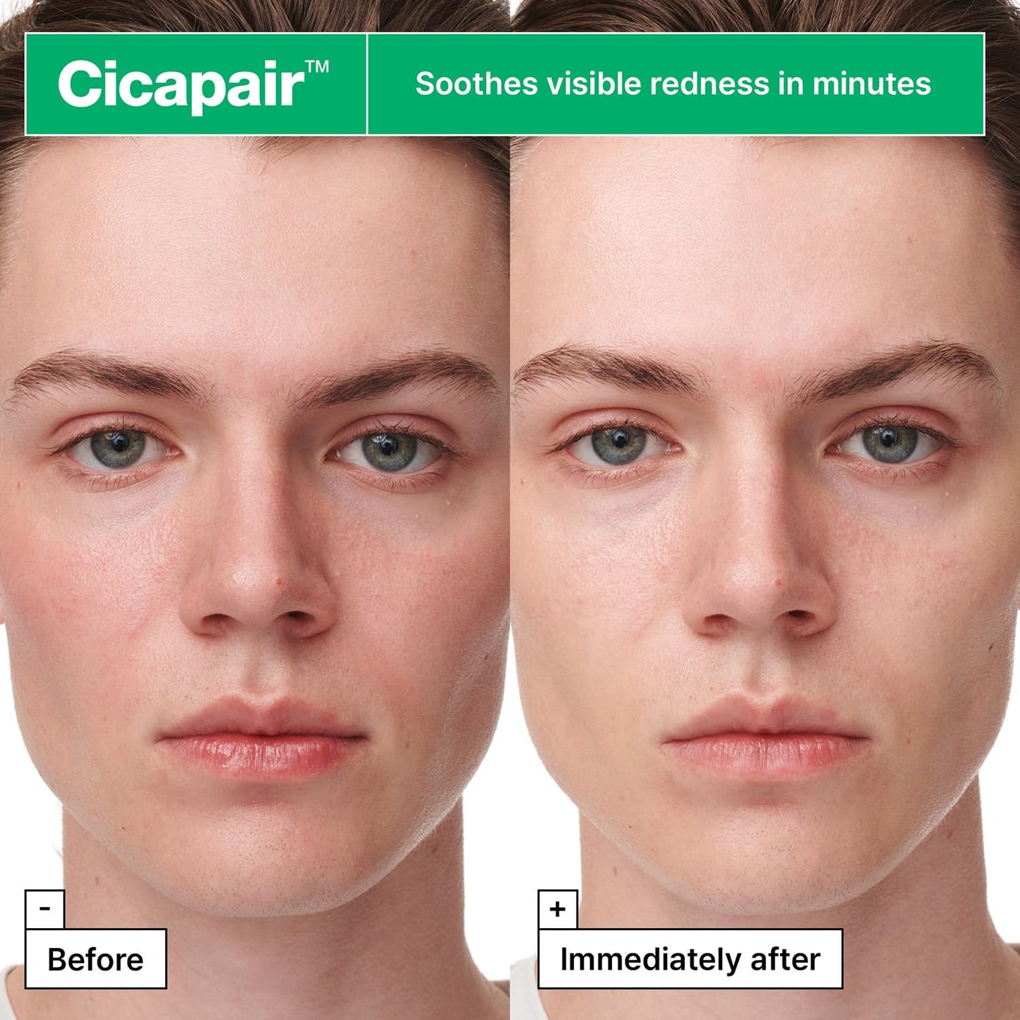 Dr.Jart+ Cicapair™ Sensitive Skin Serum Face Mask For Redness 5 Sheets x 25g