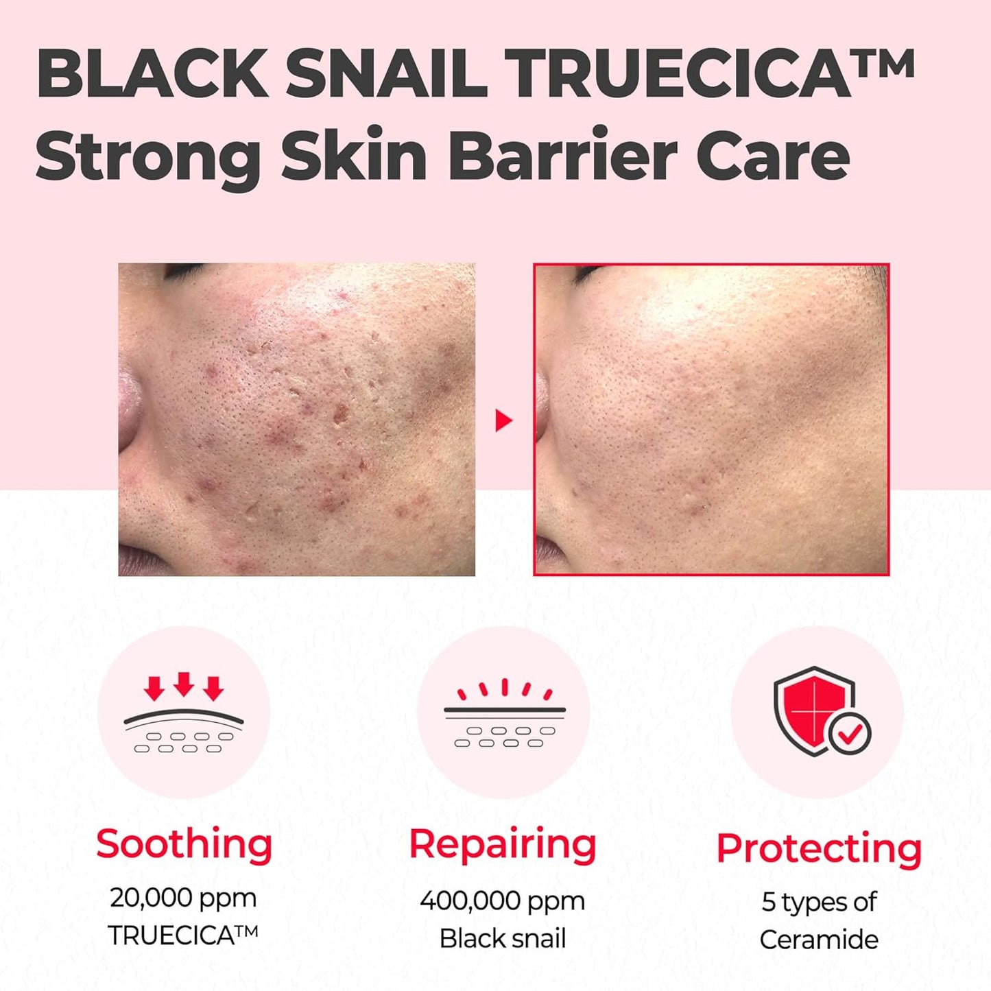 SOME BY MI Snail Truecica Miracle Repair Cream 60g