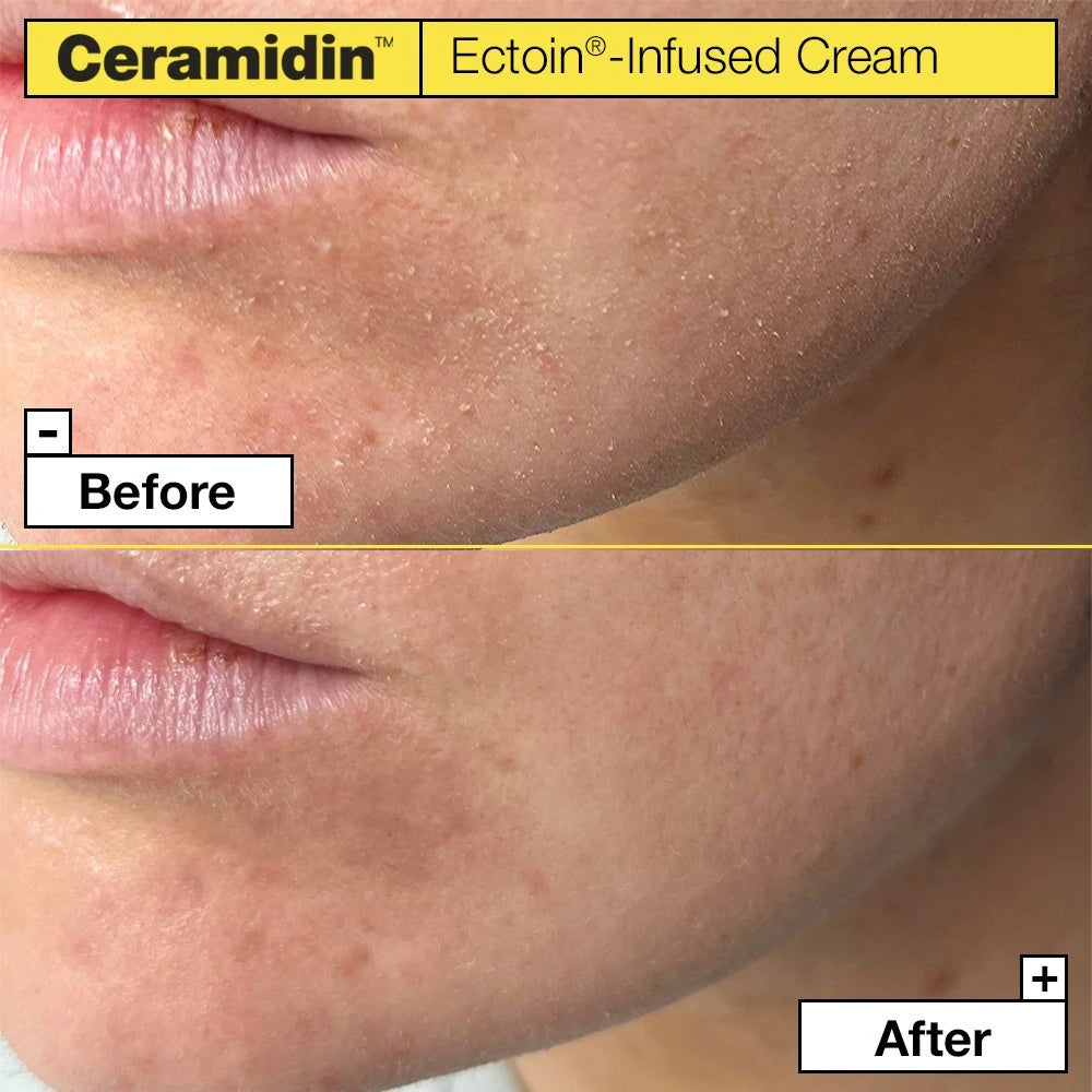 Dr.Jart+ Ceramidin Ectoin-Infused Cream 50ml